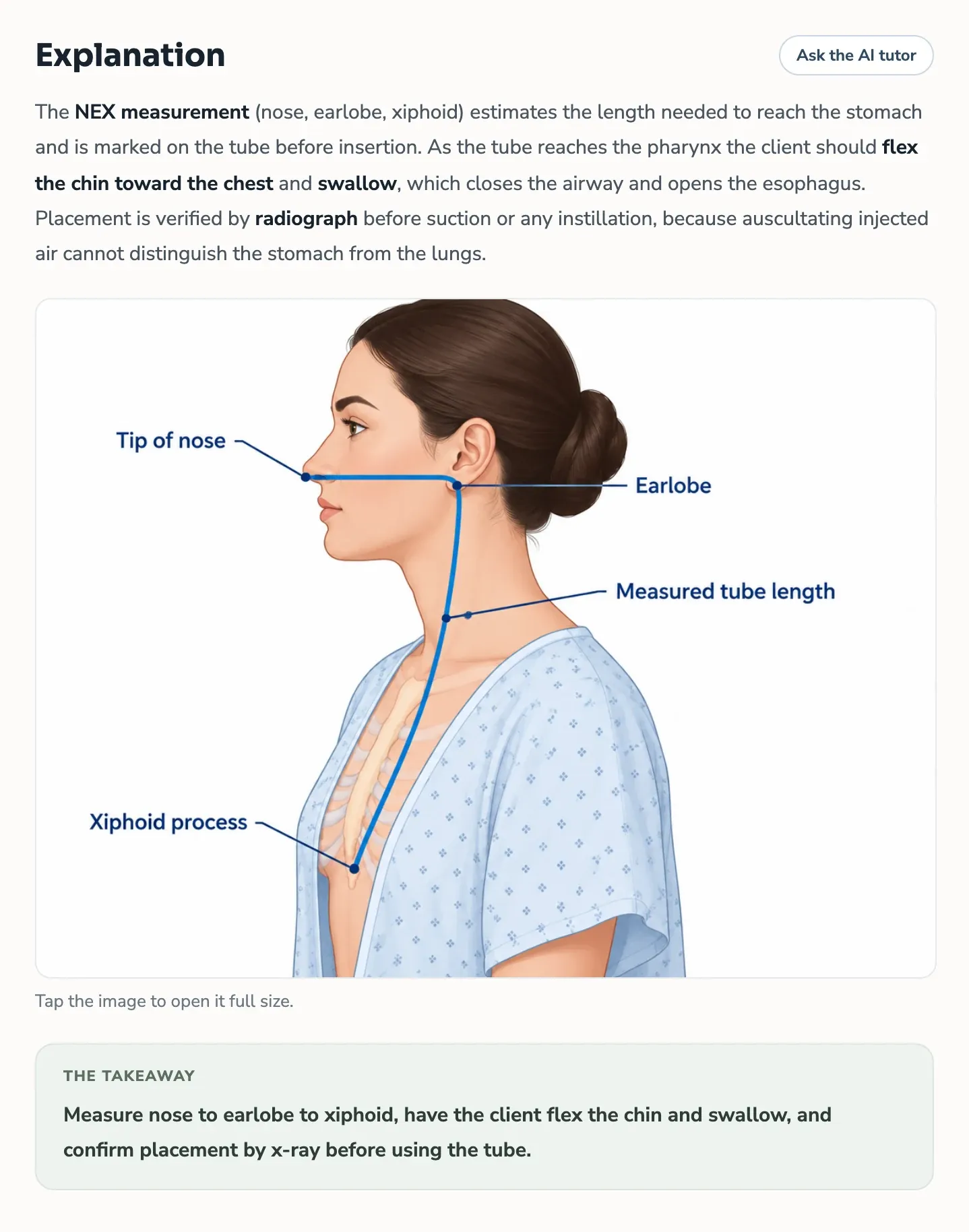 A rationale on inserting a nasogastric tube, with an illustration of the NEX measurement: tip of the nose to the earlobe, then down to the xiphoid process